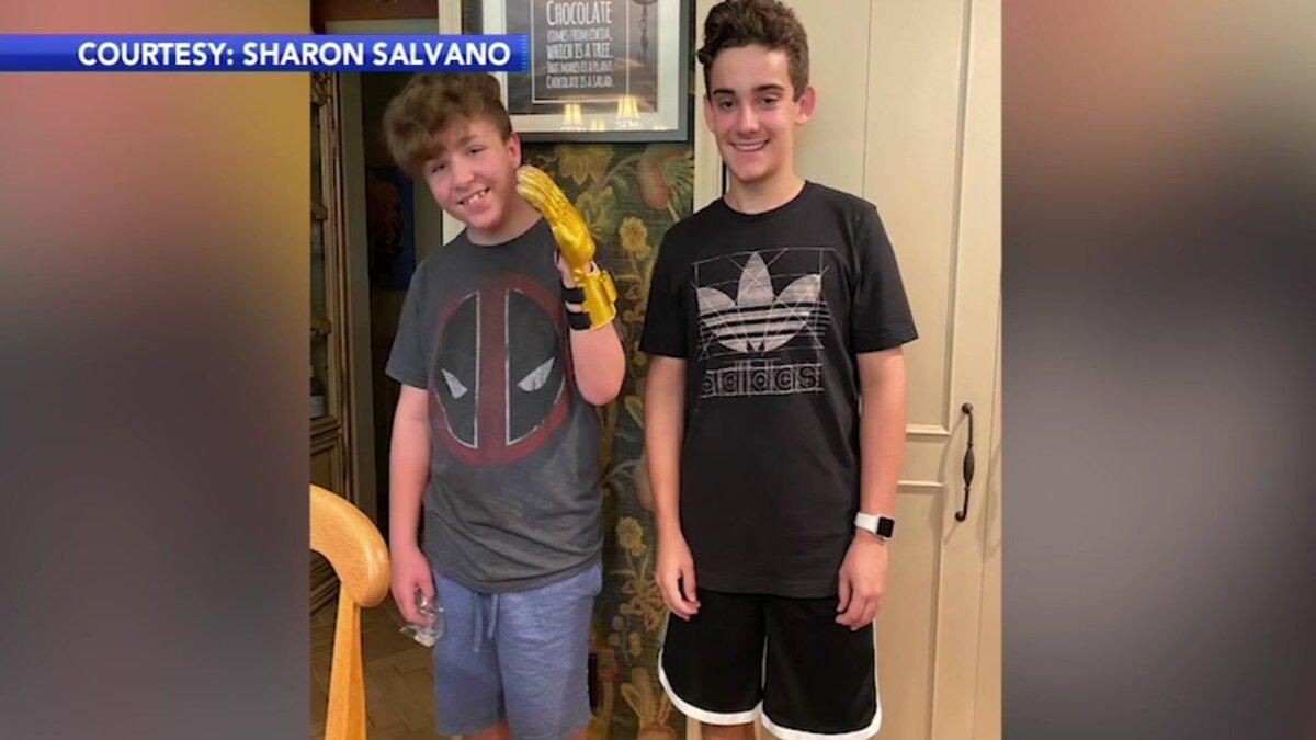 У США 14-річний хлопчик надрукував протез руки на 3D-принтері - Інновації У США 14-річний хлопчик надрукував протез руки на 3D-принтері - Інновації